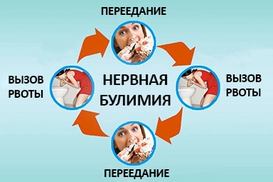 Лечение булимии в Янино-1
